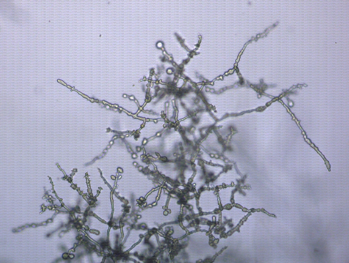 Mycélium de Phytophthora cinnamomi au microscope